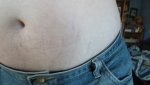 belly-rash2.jpg