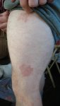 knee-rash.jpg